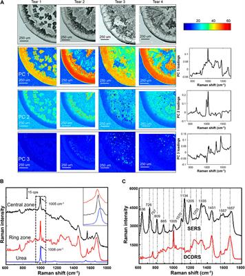 Applications of Raman spectroscopy in ocular biofluid detection